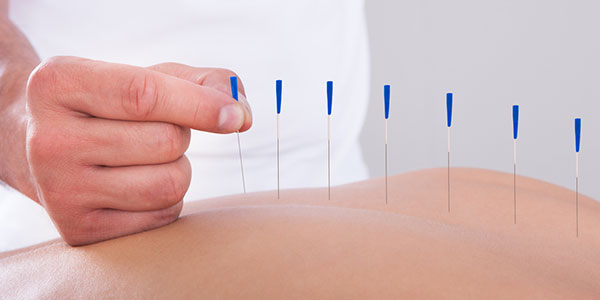 Certificate in Dry Needling