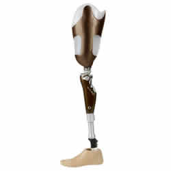 A.K Prosthesis