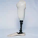 B.K Prosthesis